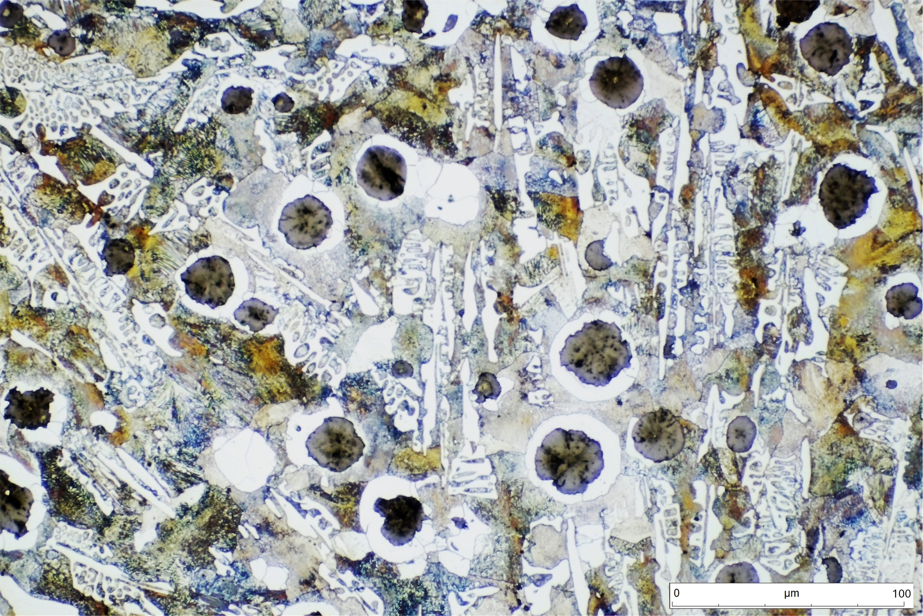 Fundición nodular de matriz mixta perlítica-cementita. Enfriamientos rápidos, como en sal superficies de la pieza, pueden fomentar la formación de ledeburita, dura y frágil. Este defecto puede subsanarse mediante un recocido posterior.