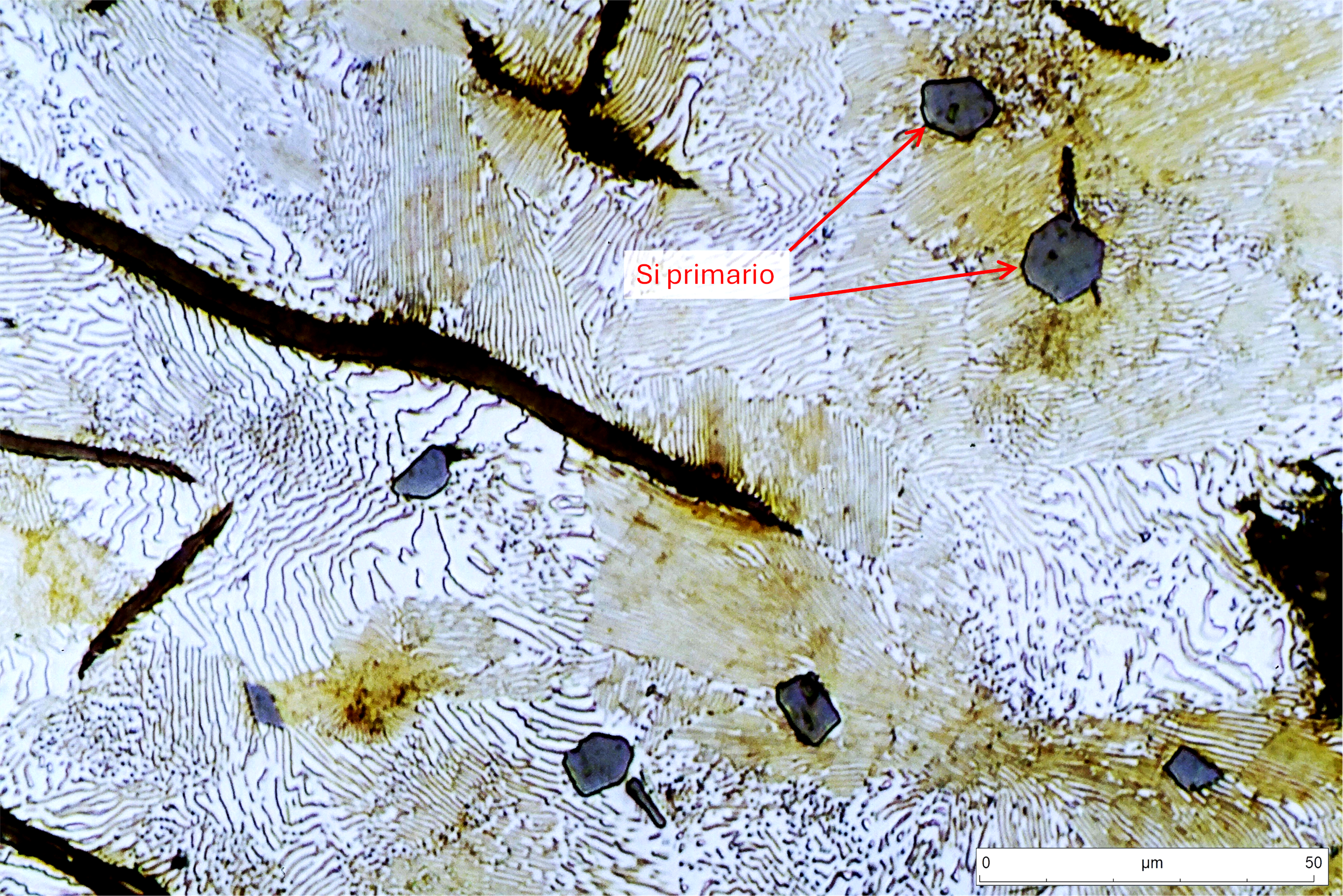 Detalle de la micrografía anterior.