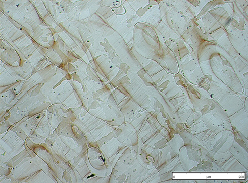 Micrografía de la estructura anterior.