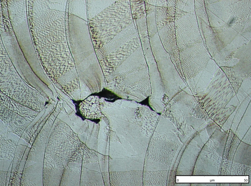 Detalle de la micrografía anterior.