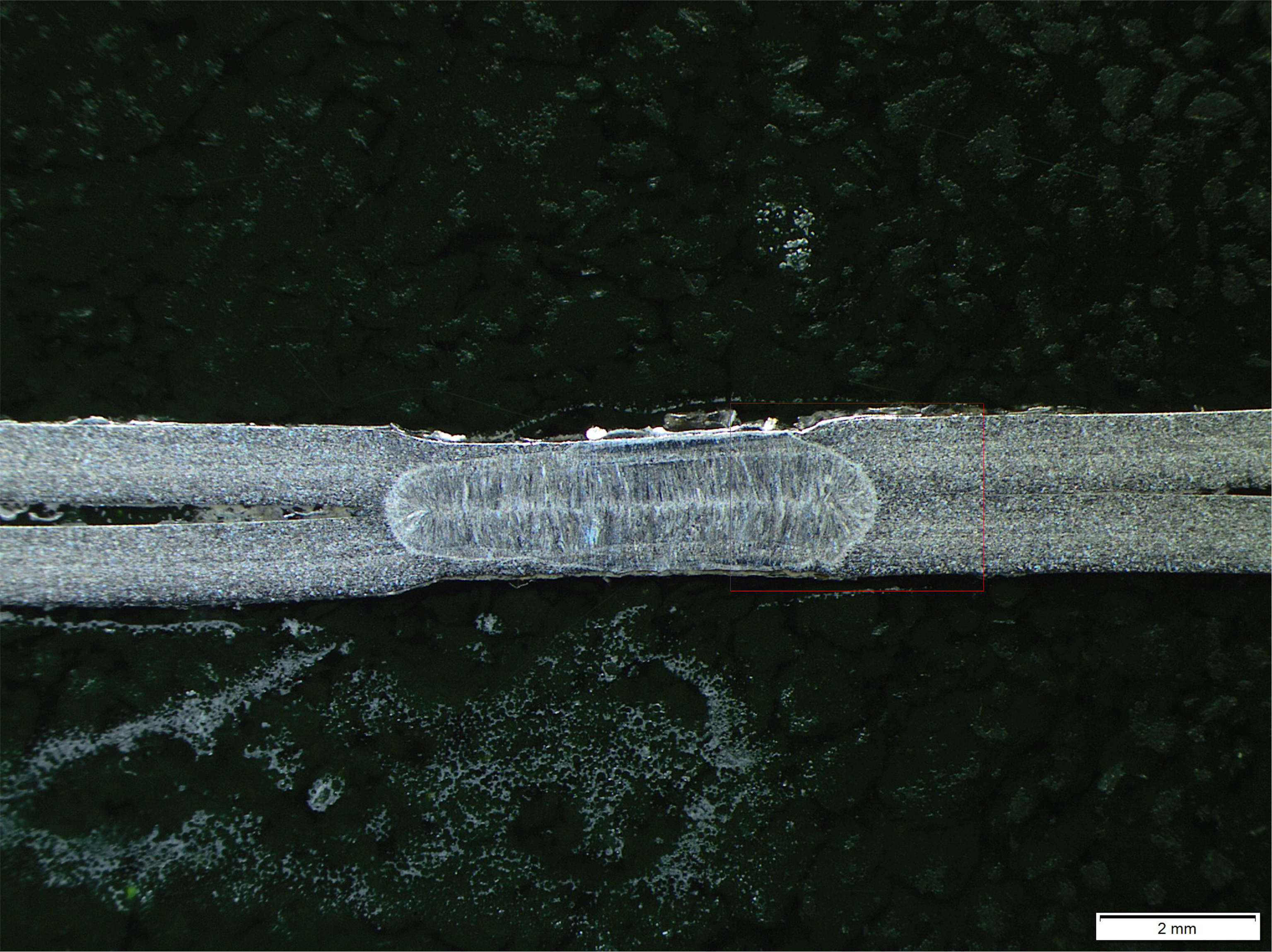 Macrografía de una unión por puntos de dos chapas de acero inoxidable X5CrNi18-10, mostrando la zona de fusión.